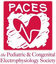 PACES: The Pediatric & Electrophysiology Society